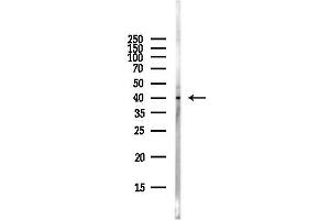 anti-Ribonucleotide Reductase M2 B (TP53 Inducible) (RRM2B) (N-Term) antibody
