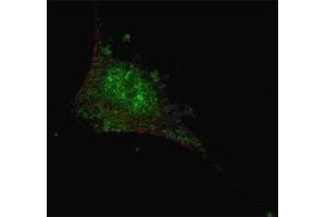 Fluorescent confocal image of SY5Y cells stained with SMAD2 antibody at 1:200.