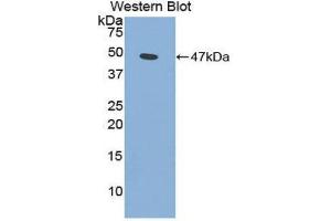 Western Blotting (WB) image for anti-Phospholipase A2, Group IIA (Platelets, Synovial Fluid) (PLA2G2A) (AA 22-146) antibody (ABIN1860250)