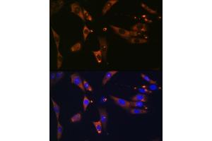 Immunofluorescence analysis of NIH-3T3 cells using ACLY Rabbit mAb (ABIN1678575, ABIN7101559, ABIN7101560 and ABIN7101561) at dilution of 1:100 (40x lens). (ACLY Antikörper)