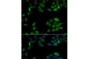 Immunofluorescence analysis of MCF7 cells using HIP1 Polyclonal Antibody (HIP1 Antikörper)