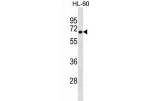 RLIM Antibody (Center) (ABIN1881751 and ABIN2838946) western blot analysis in HL-60 cell line lysates (35 μg/lane). (RLIM Antikörper  (AA 199-227))