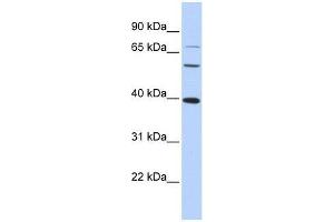 MAF antibody used at 1. (MAF Antikörper  (N-Term))