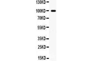 Western Blotting (WB) image for anti-Tumor Necrosis Factor Receptor Superfamily, Member 11a, NFKB Activator (TNFRSF11A) (AA 35-214) antibody (ABIN3042334)