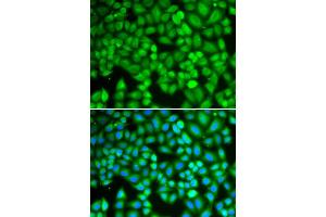 Immunofluorescence analysis of U2OS cell using WAS antibody. (WASP Antikörper)