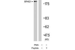 Western blot analysis of extract from 293 cells, using EIF4G1 polyclonal antibody . (EIF4G1 Antikörper  (Ser1232))