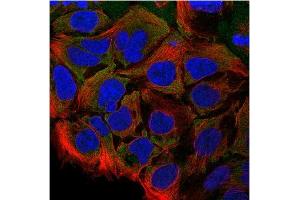 Immunofluorescence: This antibody stained CACO-2 cells.