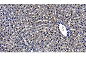 Immunohistochemistry (IHC) image for anti-Myeloid Differentiation Primary Response Gene (88) (MYD88) (AA 1-296) antibody (ABIN7440665)