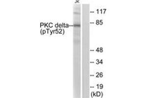Western blot analysis of extracts from Jurkat cells treated with starved 24h, using PKC delta (Phospho-Tyr52) Antibody. (PKC delta Antikörper  (pTyr52))