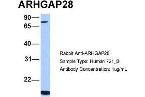 Human 721_B; Host:Rabbit. (ARHGAP28 Antikörper  (C-Term))