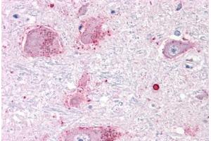 Anti-CHRM3 / M3 antibody  ABIN1048442 IHC staining of human brain, neurons and glia. (CHRM3 Antikörper  (C-Term))