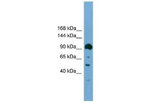 WB Suggested Anti-Ddx20 Antibody Titration:  0.