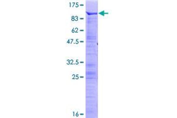 MECP2 Protein (AA 1-486) (GST tag)