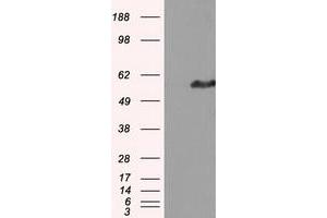 Western Blotting (WB) image for anti-Intraflagellar Transport 57 Homolog (IFT57) antibody (ABIN1498808) (IFT57 Antikörper)