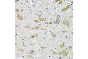 Immunohistochemistry of paraffin-embedded mouse spinal cord using CCT4 antibody (ABIN2561655) at dilution of 1:100 (40x lens). (CCT4 Antikörper)