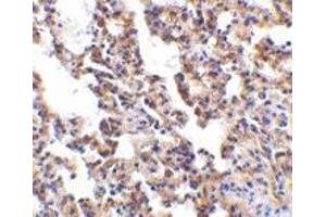 Immunohistochemistry of IL-21 receptor in rat lung with IL-21 receptor antibody at 10 μg/ml. (IL21 Receptor Antikörper  (Extracellular Domain))