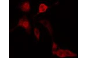 ABIN6277185 staining  Hela cells by IF/ICC. (IFIH1 Antikörper  (C-Term))