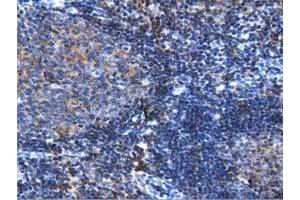 Immunohistochemical staining of paraffin-embedded Human lymph node tissue using anti-ARHGAP25 mouse monoclonal antibody. (ARHGAP25 Antikörper)