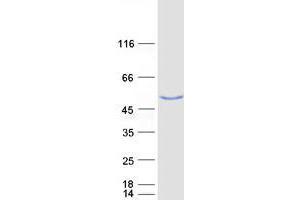 Western Blotting (WB) image for Ubiquitin Specific Peptidase 3 (USP3) protein (Myc-DYKDDDDK Tag) (ABIN2735105)