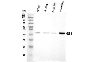 Western blot analysis of GJB2 using anti-GJB2 antibody (ABIN7602589).