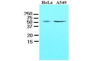 Western Blotting (WB) image for anti-Kruppel-Like Factor 4 (Gut) (KLF4) (AA 1-170), (N-Term) antibody (ABIN336104)