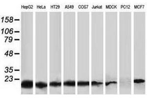 Image no. 3 for anti-Destrin (Actin Depolymerizing Factor) (DSTN) antibody (ABIN1497909) (Destrin Antikörper)
