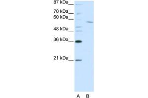 Western Blotting (WB) image for anti-REST Corepressor 1 (RCOR1) antibody (ABIN2461866) (CoREST Antikörper)