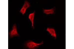 ABIN6276004 staining COLO205 by IF/ICC. (GPR114 Antikörper  (Internal Region))