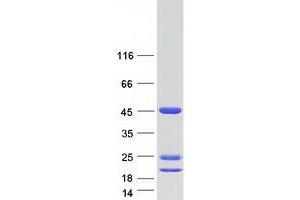 Western Blotting (WB) image for Asparaginase Like 1 (ASRGL1) (Transcript Variant 2) protein (Myc-DYKDDDDK Tag) (ABIN2724438)