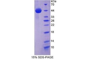 SDS-PAGE analysis of Mouse AST Protein.