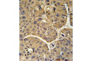 Immunohistochemistry (Paraffin-embedded Sections) (IHC (p)) image for anti-Complement Factor H-Related 5 (CFHR5) (AA 203-231) antibody (ABIN651876)