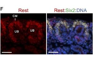 Co-immunostaining for anti-Rest (red) and Six2 (green) showing higher expression levels of Rest in Six2+ cap mesenchyme (CM) surrounding ureteric bud (UB). (REST Antikörper  (AA 401-450))