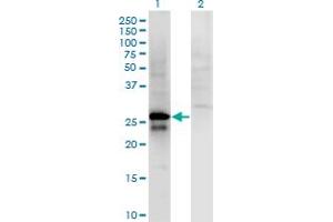 Western Blot analysis of SP2 expression in transfected 293T cell line by SP2 monoclonal antibody (M01), clone 5D3.