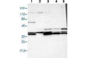 Western blot analysis of Lane 1: RT-4, Lane 2: U-251 MG, Lane 3: A-431, Lane 4: Liver, Lane 5: Tonsil with ADA polyclonal antibody  at 1:100-1:250 dilution. (ADA Antikörper)