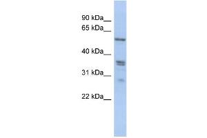 WB Suggested Anti-SLC38A2 Antibody Titration:  0. (SLC38A2 Antikörper  (N-Term))