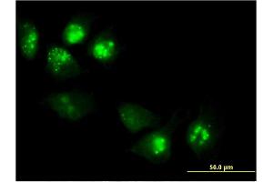 Immunofluorescence of monoclonal antibody to PHLDA1 on HeLa cell. (PHLDA1 Antikörper  (AA 1-109))