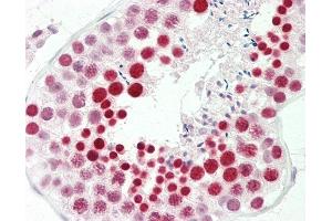 Anti-RBMXL2 antibody IHC staining of human testis. (RBMXL2 Antikörper  (AA 215-264))