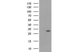Western Blotting (WB) image for anti-Hydroxyacylglutathione Hydrolase-Like (HAGHL) antibody (ABIN1498572) (HAGHL Antikörper)