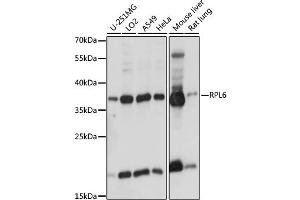 Western blot analysis of extracts of various cell lines, using RPL6 antibody (ABIN6291596) at 1:1000 dilution. (RPL6 Antikörper)