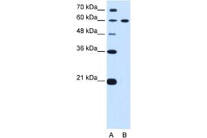 WB Suggested Anti-DTX2 Antibody Titration:  0. (DTX2 Antikörper  (C-Term))