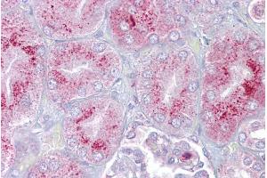 Immunohistochemistry with Kidney tissue at an antibody concentration of 5µg/ml using anti-P2RX2 antibody (ARP35436_P050) (P2RX2 Antikörper  (N-Term))