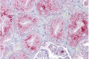 Immunohistochemistry (IHC) image for anti-Purinergic Receptor P2X, Ligand Gated Ion Channel 2 (P2RX2) (N-Term) antibody (ABIN2776293)
