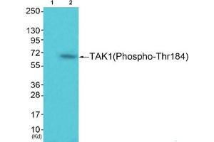 Western blot analysis of extracts from 293 cells (Lane 2), using TAK1 (Phospho-Thr184) Antibody.