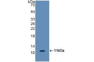 Detection of Recombinant S100A8, Mouse using Polyclonal Antibody to S100 Calcium Binding Protein A8 (S100A8) (S100A8 Antikörper  (AA 1-89))