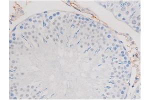 ABIN6267487 at 1/200 staining Rat testis tissue sections by IHC-P. (alpha Adducin Antikörper  (pSer726))