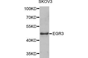 Western blot analysis of extracts of SKOV3 cells, using EGR3 antibody. (EGR3 Antikörper)
