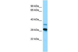 WB Suggested Anti-LYPLAL1 Antibody Titration: 1. (LYPLAL1 Antikörper  (C-Term))