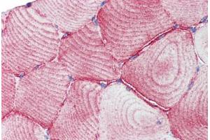 Immunohistochemistry (Paraffin-embedded Sections) (IHC (p)) image for anti-TEA Domain Family Member 1 (SV40 Transcriptional Enhancer Factor) (TEAD1) (C-Term) antibody (ABIN462220)