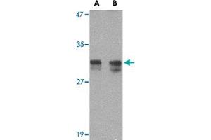 Western blot analysis of RASD2 in rat colon tissue lysate with RASD2 polyclonal antibody  at (A) 1 and (B) 2 ug/mL . (RASD2 Antikörper  (N-Term))