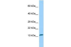 Western Blotting (WB) image for anti-Fast Skeletal Troponin C (TNNC2) (N-Term) antibody (ABIN2790315) (TNNC2 Antikörper  (N-Term))